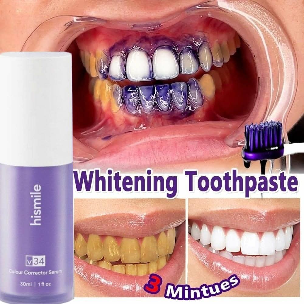 Hismile V34 Purple Whitening Toothpaste - Brighten and Freshen Your Smile - Asm Veo #